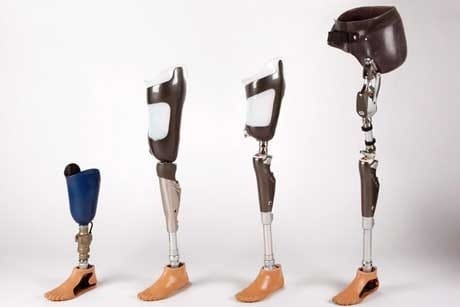 artificial limb prosthetics 500x500 Copy